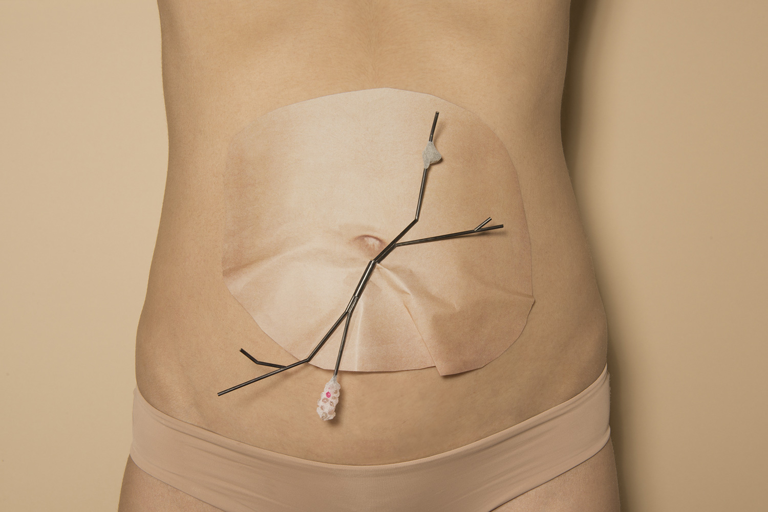 « Blooming Species », eine Schmuckserie